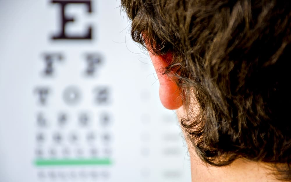 balints-syndrome-a-straight-complication-of-stroke