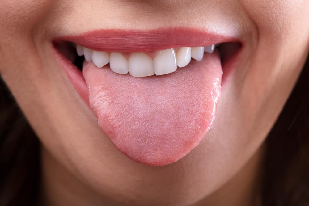 tongue-can-tell-your-health