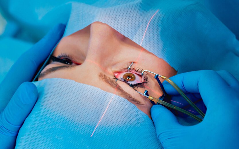 cornea-transplant-surgery
