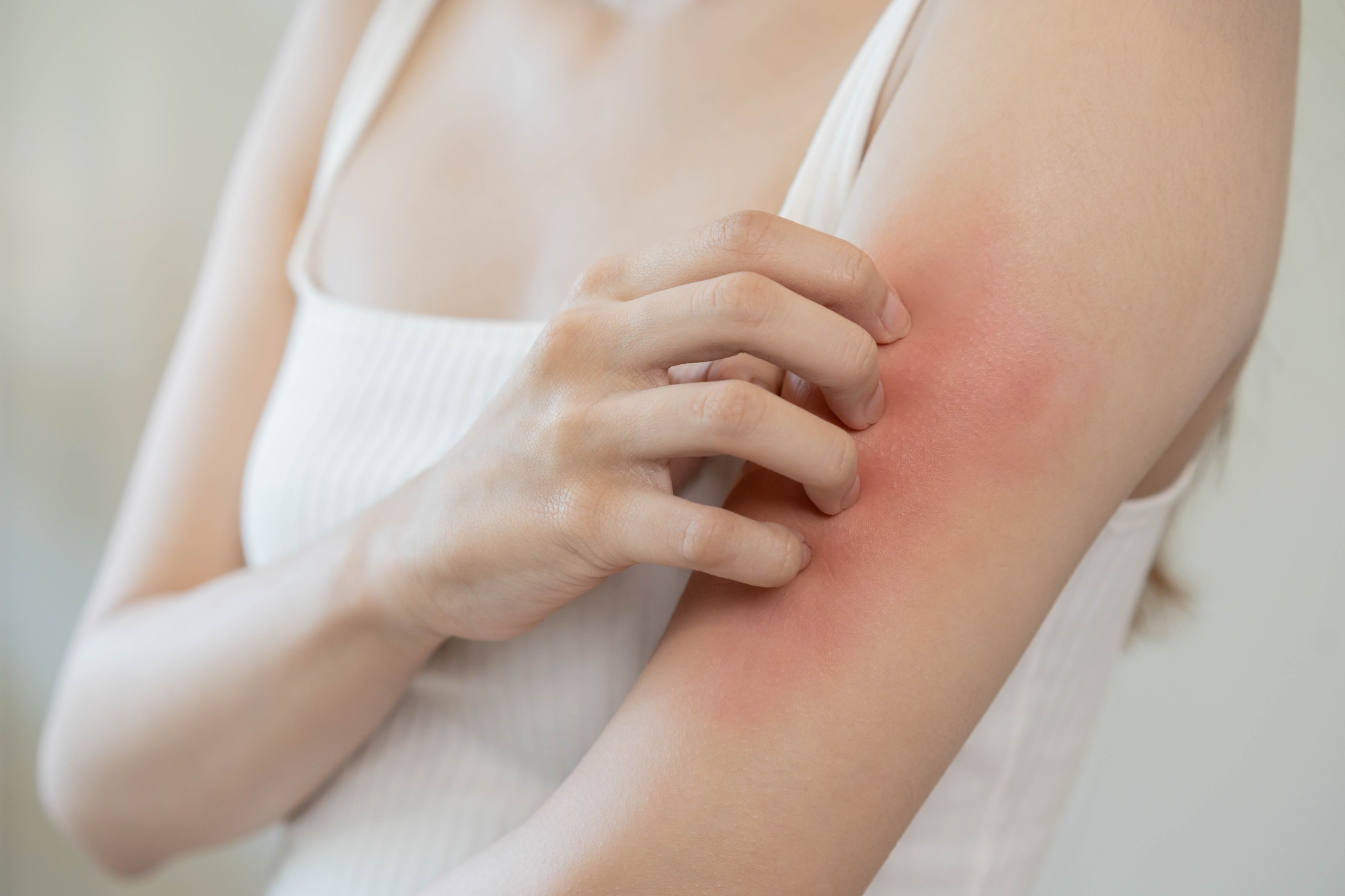 unspecified-itchy-skin-symptom-and-solutions