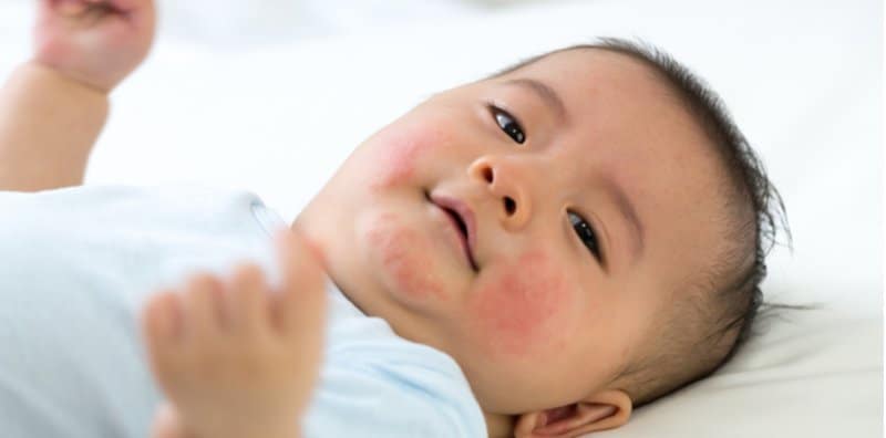 how-to-prevent-baby-from-getting-allergies