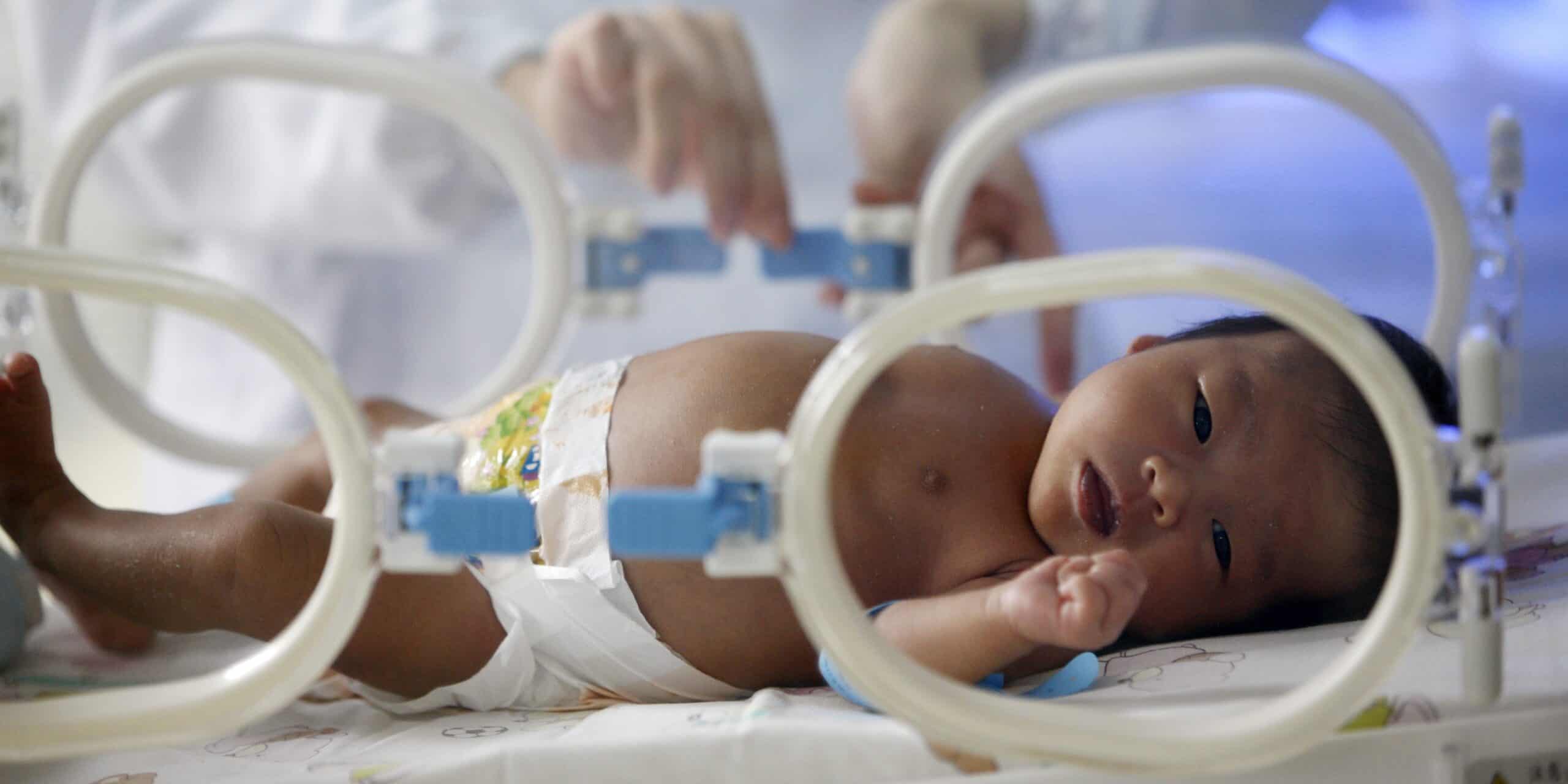 patients-stories-of-spinal-bifida