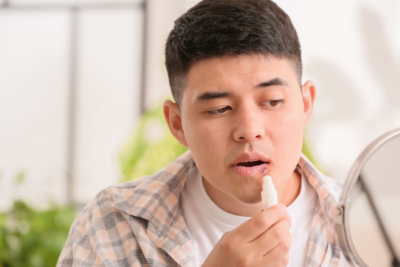 cheilitis