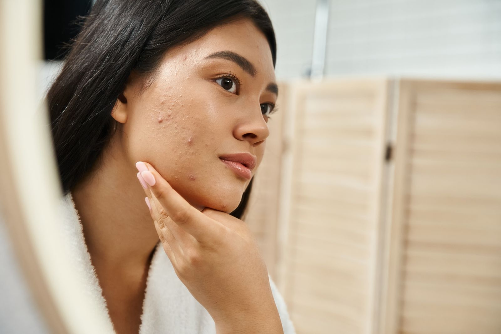 oral-isotretinoin-acne-guide